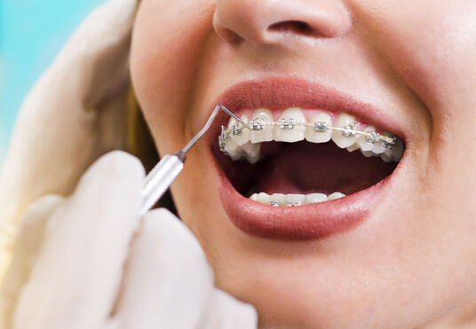 What Are Orthodontics